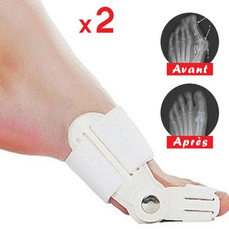 CORRECTIVE Hallux Valgus - Oignon du pied