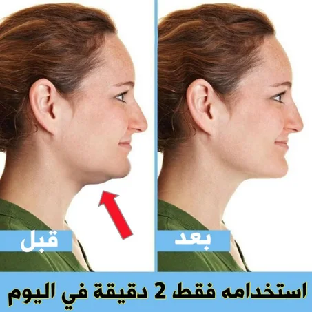 المشد السحري لشد بشرة الوجه والتخلص من اللغلوغ بدون جراحة