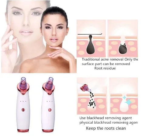 Electric Blackhead Cleaner Blackhead Acne Vacuum Cleaner Pore Beauty Skin Care Tool Face And Nose Deep Cleaning Suction Machine 4.9
