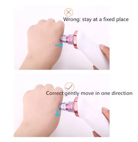 Electric Blackhead Cleaner Blackhead Acne Vacuum Cleaner Pore Beauty Skin Care Tool Face And Nose Deep Cleaning Suction Machine 4.9