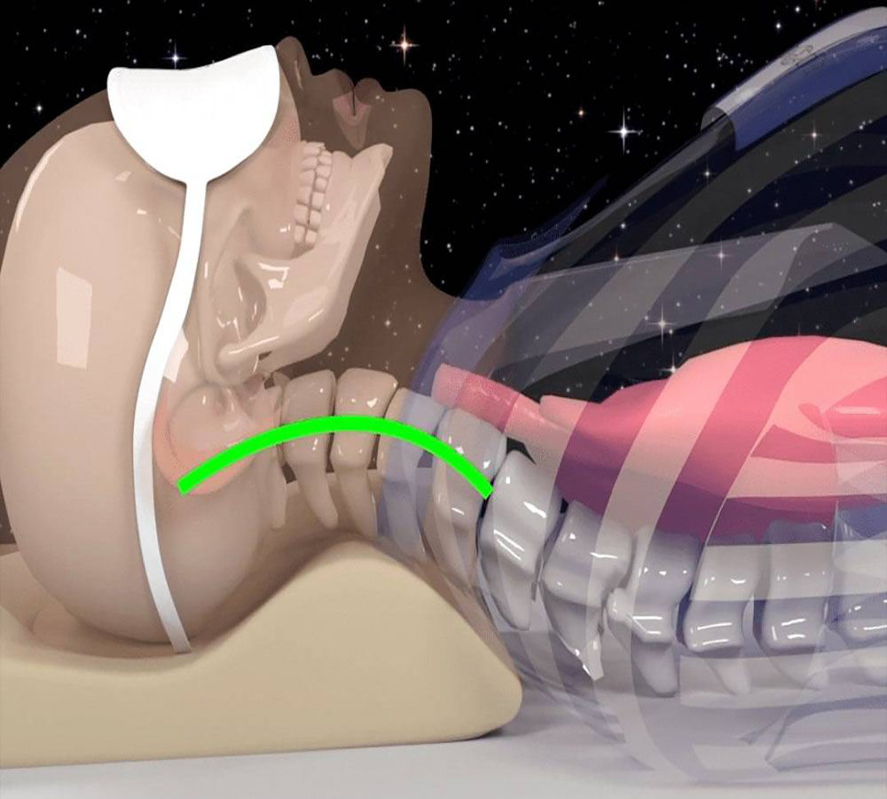 وسادة طبية من إسفنج ميموري فوم لعلاج آلام الرقبة، الشخير وصعوبة التنفس للنوم على الظهر والجانبين