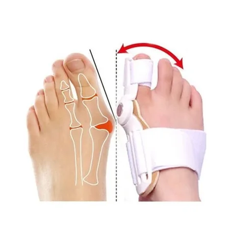 2 Correcteurs pieds pour Hallux-Valgus.