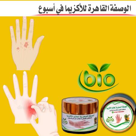 الوصفة السحرية لعلاج الأكزيما في أسبوع