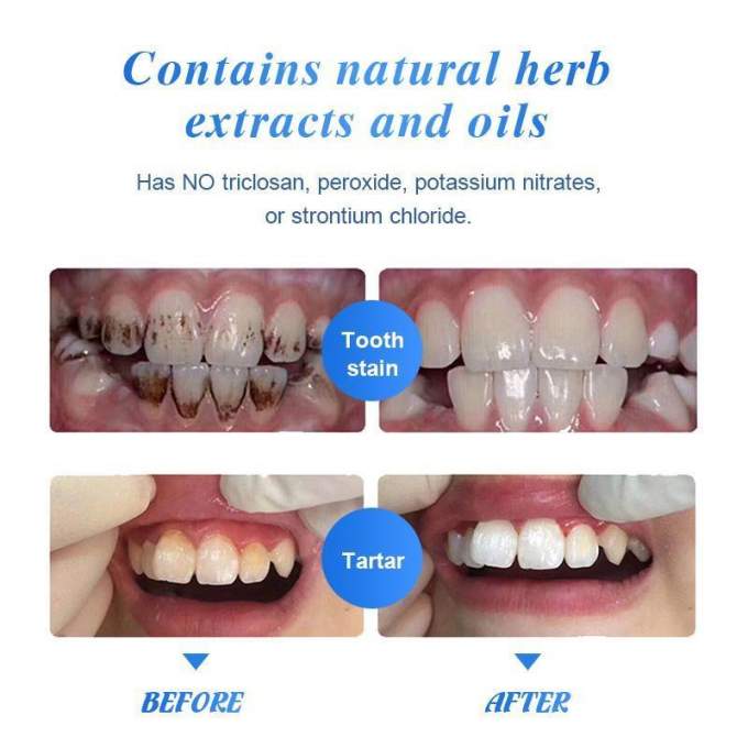 Viaty Toothpaste منتوج تبييض الأسنان