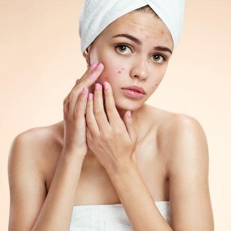 ACNÉ / PEAUX JEUNES