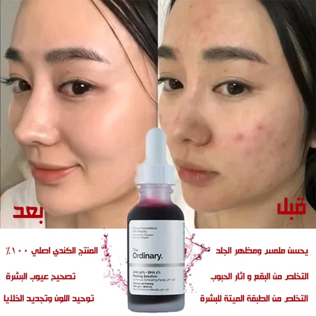 اردنري للبقع و اثار الحبوب