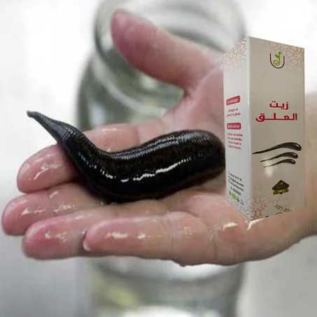 زيت العلق