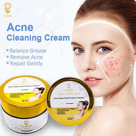 كريم علاج  حب الشباب سريع المفعول